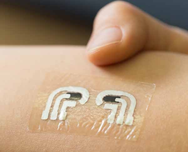 A skin tattoo that measures the glucose level of diabetics