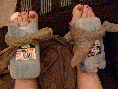 Five things to know about gout