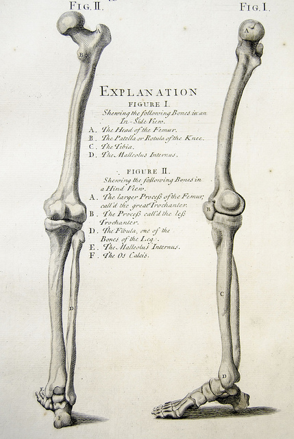 Has osteoporosis been mistreated?