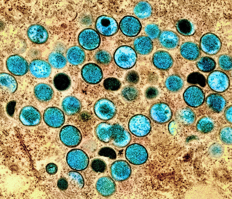 Should you be worried about monkeypox?