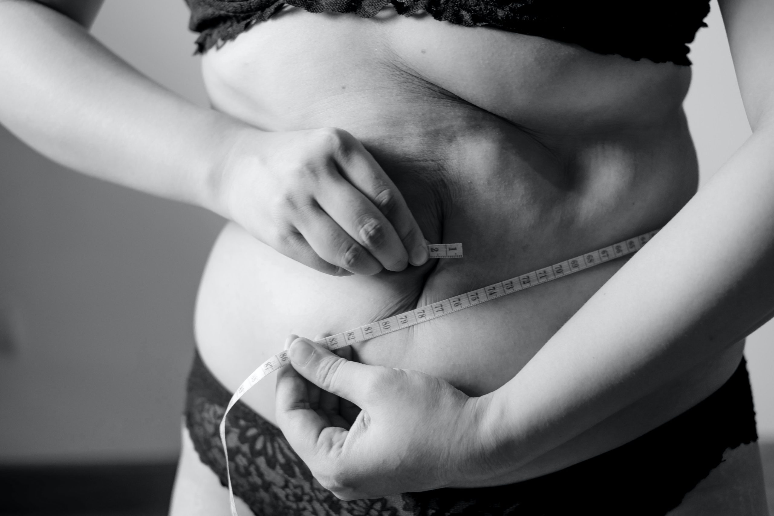 Why doesn’t Medicare cover Ozempic and other drugs for weight loss?